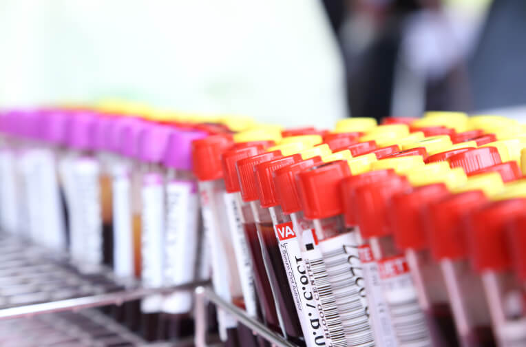 blood tubes for analysis